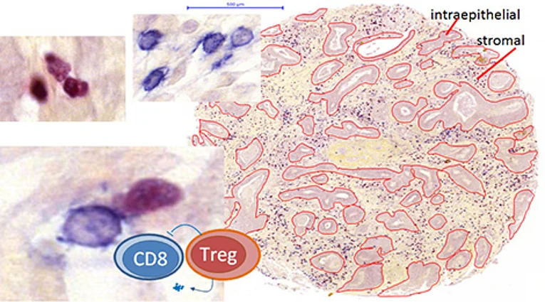 CD8 und FoxP3